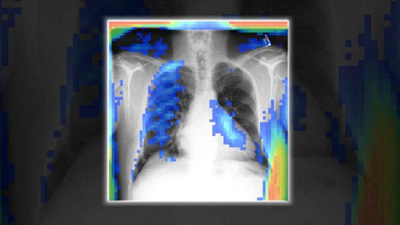 Šis bezmaksas AI lasa rentgena starus, kā arī ārstus