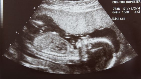 Um ultrassom barato produz fotos de bebês minúsculos por um custo minúsculo