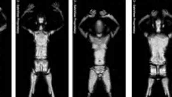 Escáneres de cuerpo entero en los aeropuertos: lo bueno, lo malo y lo feo