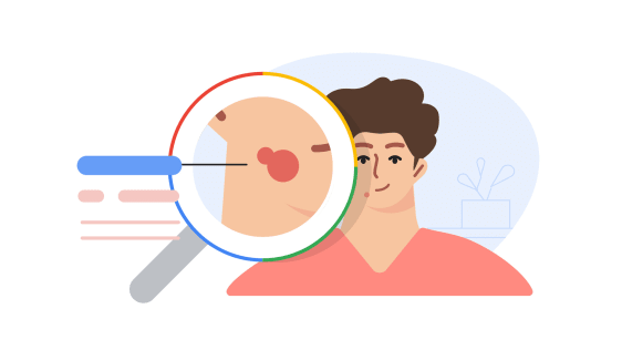 O novo dermatologista de IA do Google pode ajudá-lo a descobrir o que é essa mancha